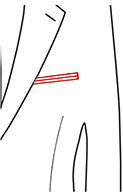 Jetted Pocket