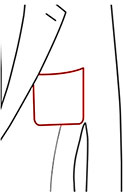 Patch Pocket